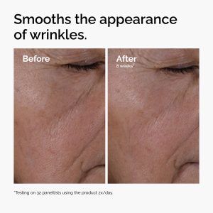 ord-multi-peptide-ha-serum-wrinkles-before-after.jpg