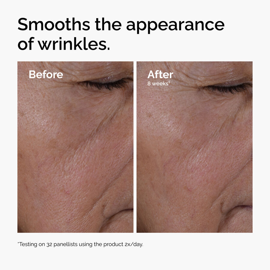 ord-multi-peptide-ha-serum-wrinkles-before-after.jpg