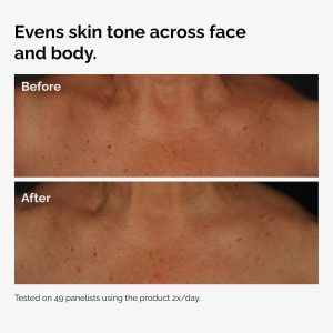 ord-niacinamide-face-body-serum-before-after-even-tone-graphic.jpg