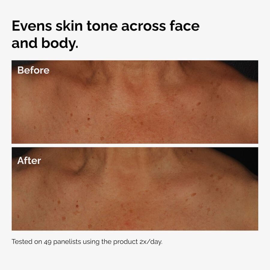 ord-niacinamide-face-body-serum-before-after-even-tone-graphic.jpg
