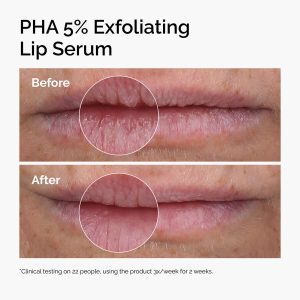 ord-pha-5pct-lip-exfoliating-serum-before-after.jpg