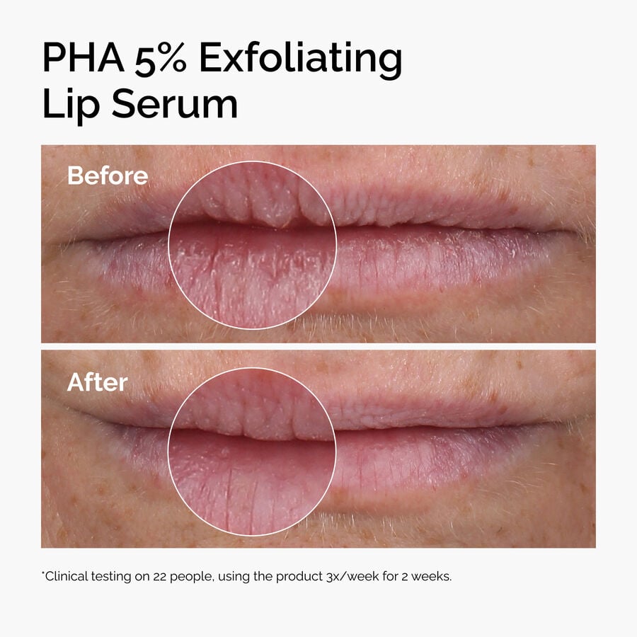 ord-pha-5pct-lip-exfoliating-serum-before-after.jpg