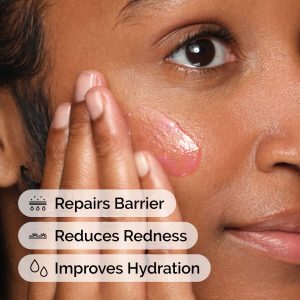 ord-soothing-barrier-support-serum-model-application-with-benefits.jpg